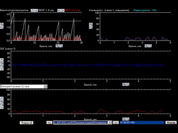 Комплекс БОС коррекции зрения «Биосвязь»