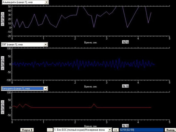 Комплекс БОС коррекции психоэмоционального состояния «Биосвязь»