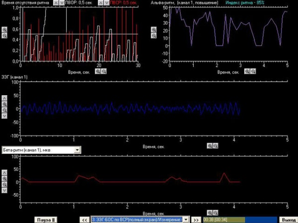 Комплекс БОС коррекции психоэмоционального состояния «Биосвязь»